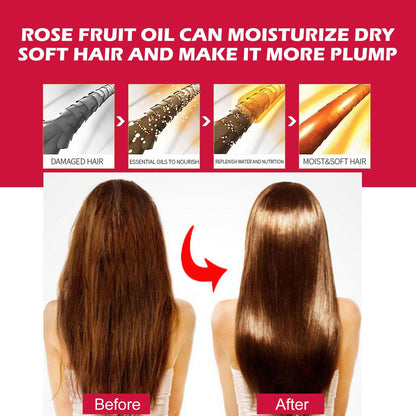 Rosehip Facial Oil For Facial And Body Hydration, Nourishing Skin Care, Smooth Hair Care, And Massage Oil