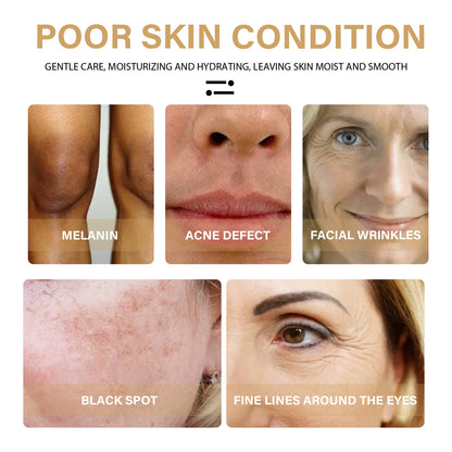 Turmeric Dark Spot Correcting Serum Face Care Spot Moisturizing Nourishing Repairing Complexion Serum