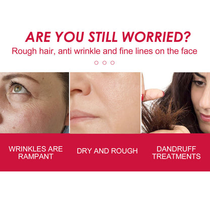 Rosehip Facial Oil For Facial And Body Hydration, Nourishing Skin Care, Smooth Hair Care, And Massage Oil