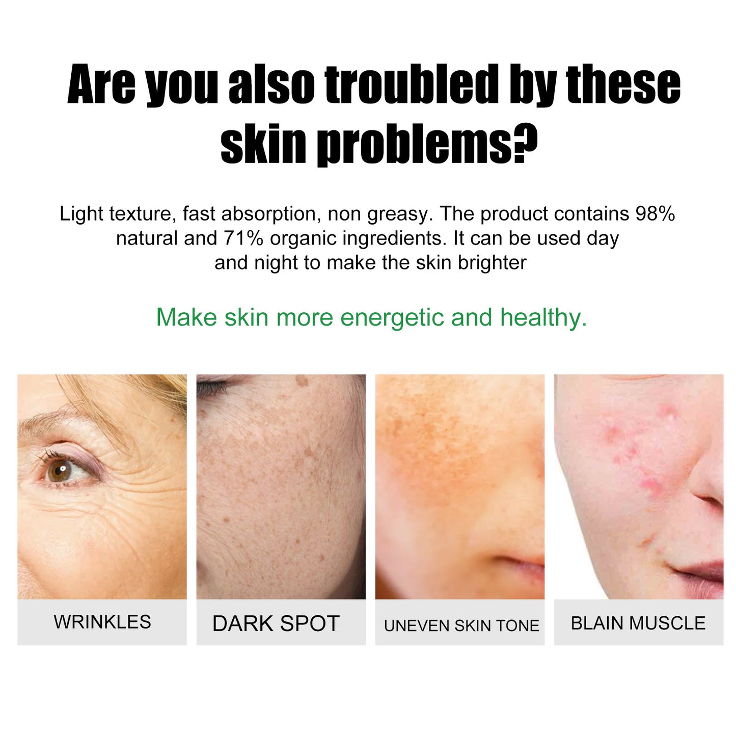 Acne & Blemish Cream Lightens Blemishes & Acne Brightens Skin Complexion Moisturizing Skin Repair Cream