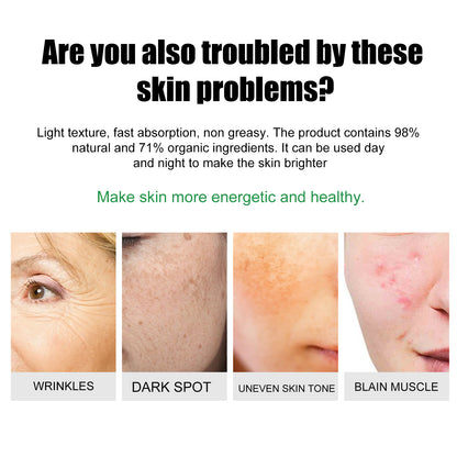 Acne & Blemish Cream Lightens Blemishes & Acne Brightens Skin Complexion Moisturizing Skin Repair Cream